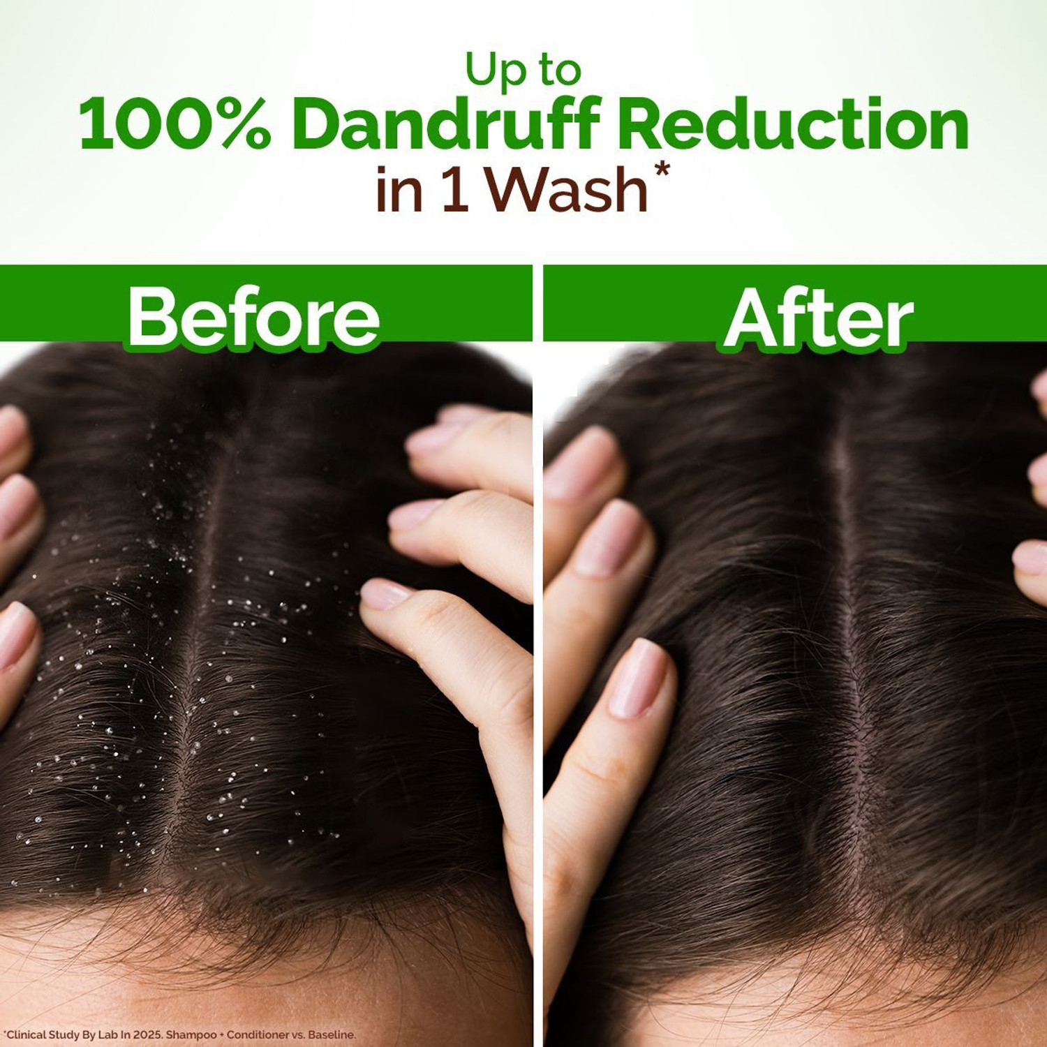 Image of Mamaearth Lemon Anti-Dandruff Shampoo with Lemon, ZPTO, Climbazole, Aloe Vera