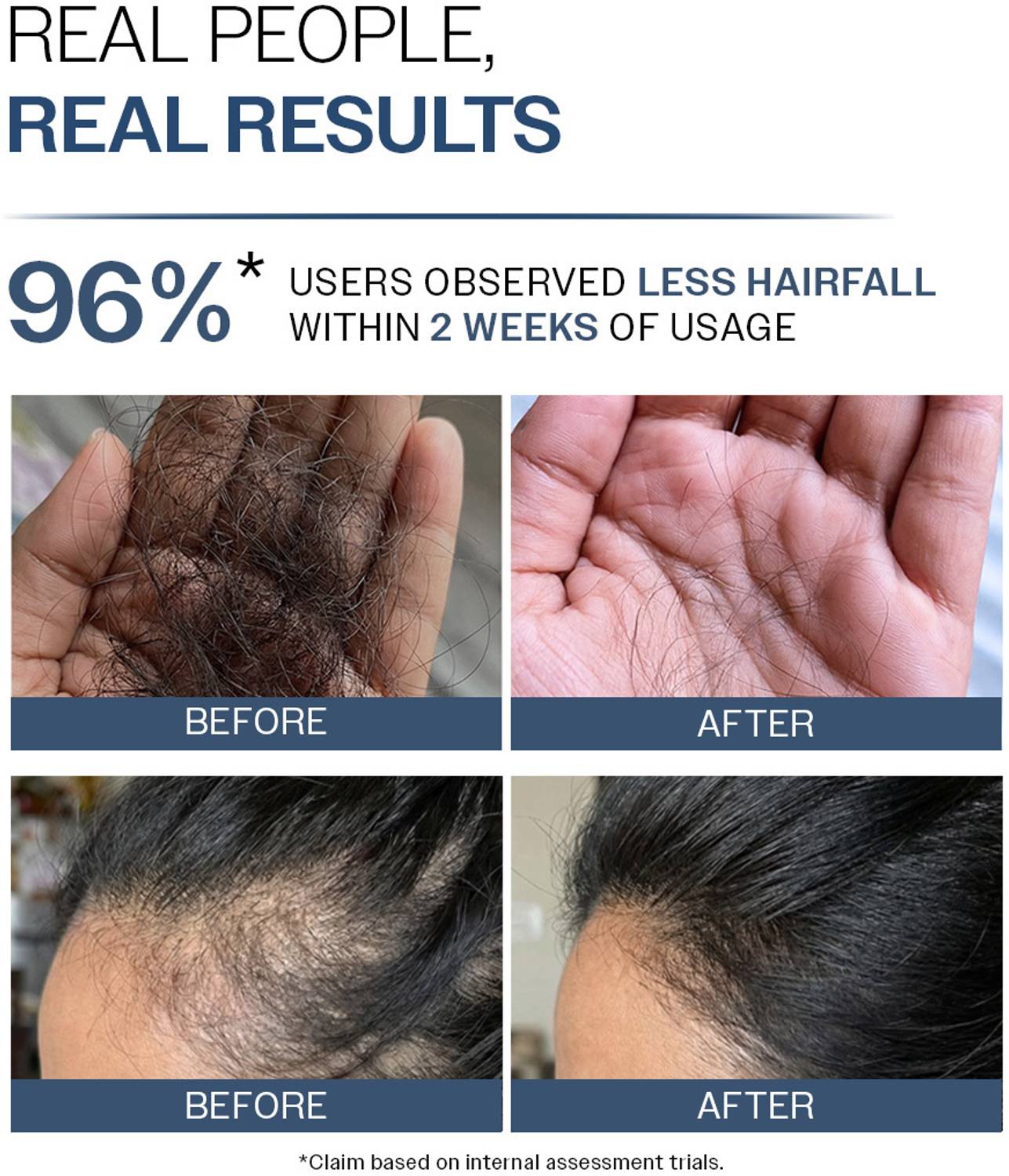 BARE Anti Hair Fall Shampoo 250ml - Image 4