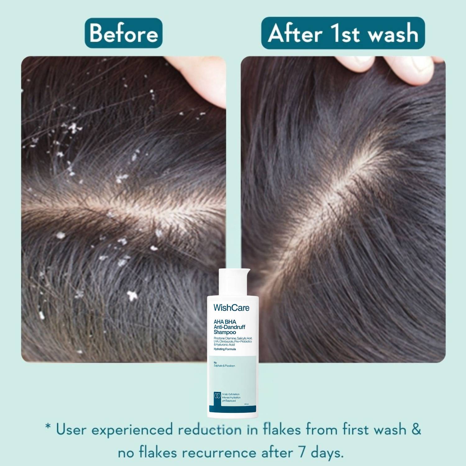WishCare Hydrating Anti Dandruff Shampoo 120ml - Image 4