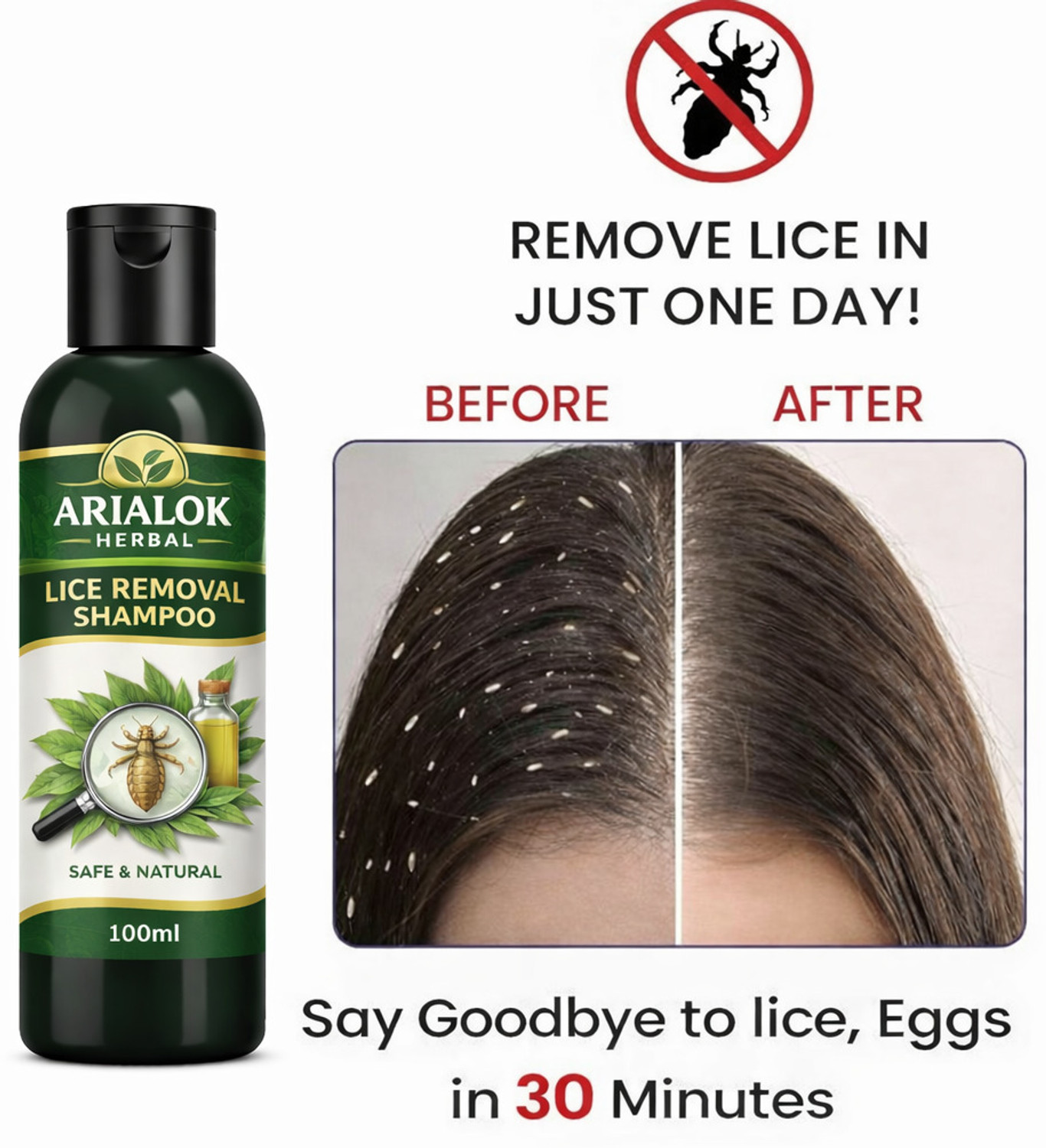 Image of ARIALOK Natural Lice Killer Shampoo,
