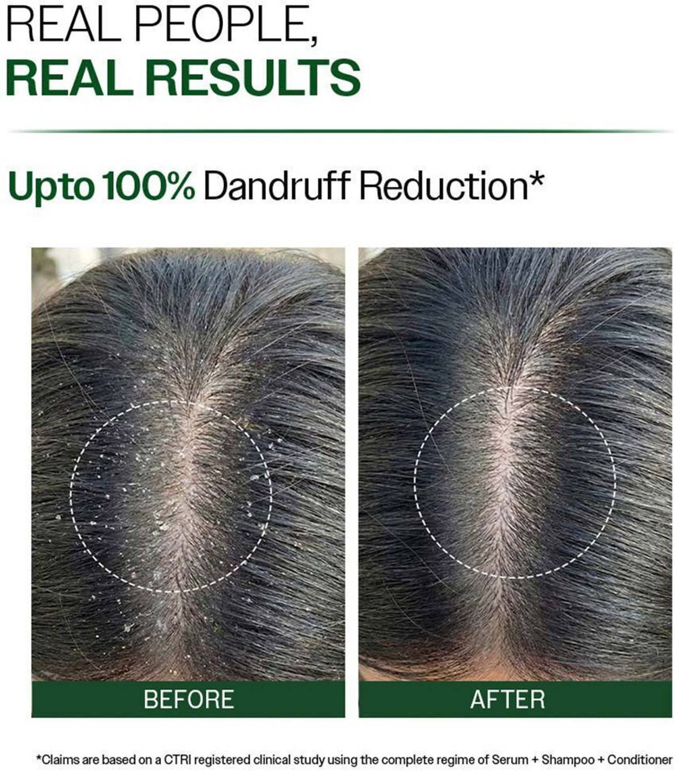 BARE ANATOMY Anti-Dandruff Shampoo 250 ml - Image 3