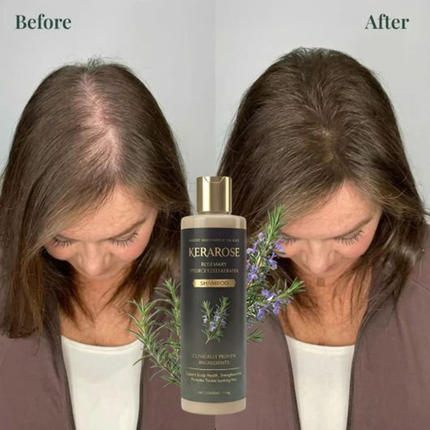 Image of Radgettim Organic Rosemary Hair Growth Shampoo Natural Thickening Strengthening Formula