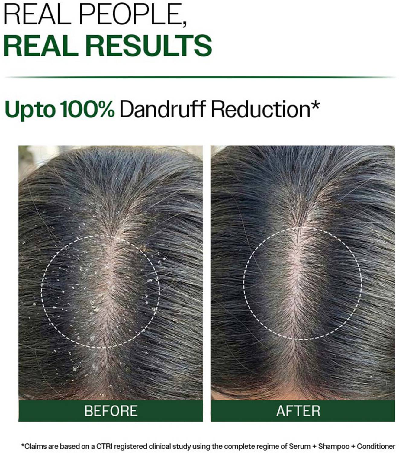 BARE ANATOMY Anti-Dandruff Shampoo 250 ml - Image 3