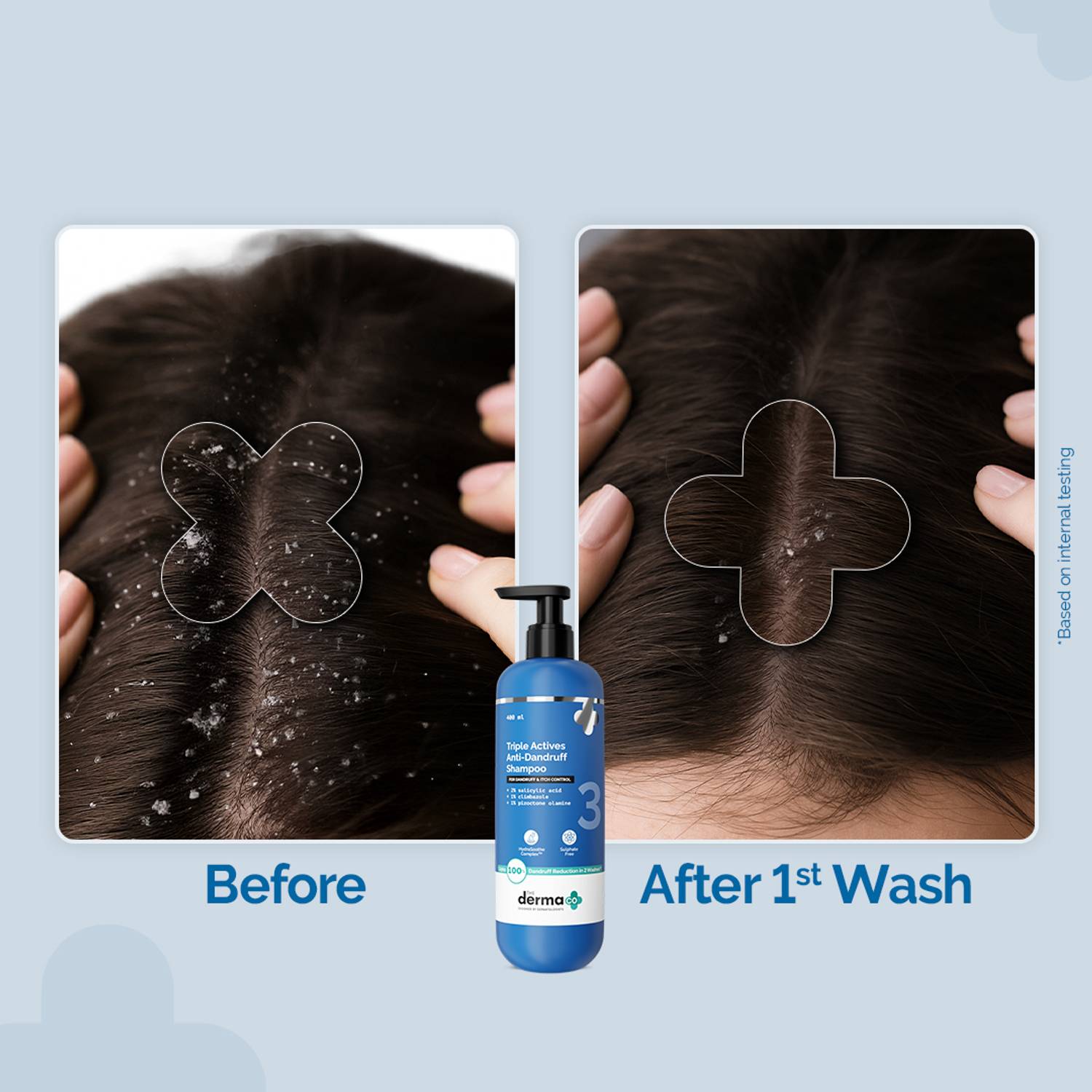 The Derma Co Triple Actives Anti-Dandruff Shampoo 400ml - Image 4