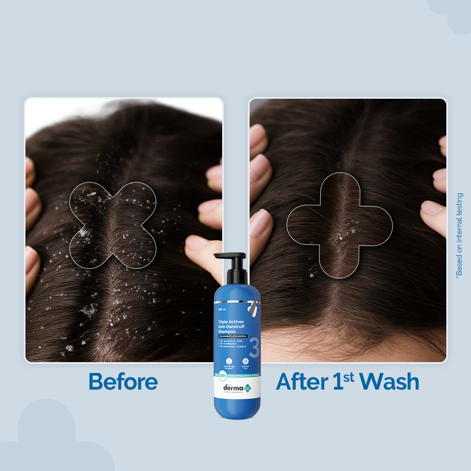 Image of The Derma Co Triple Actives Anti-Dandruff Shampoo Power of 3 Actives | Kills 99%* Dandruff