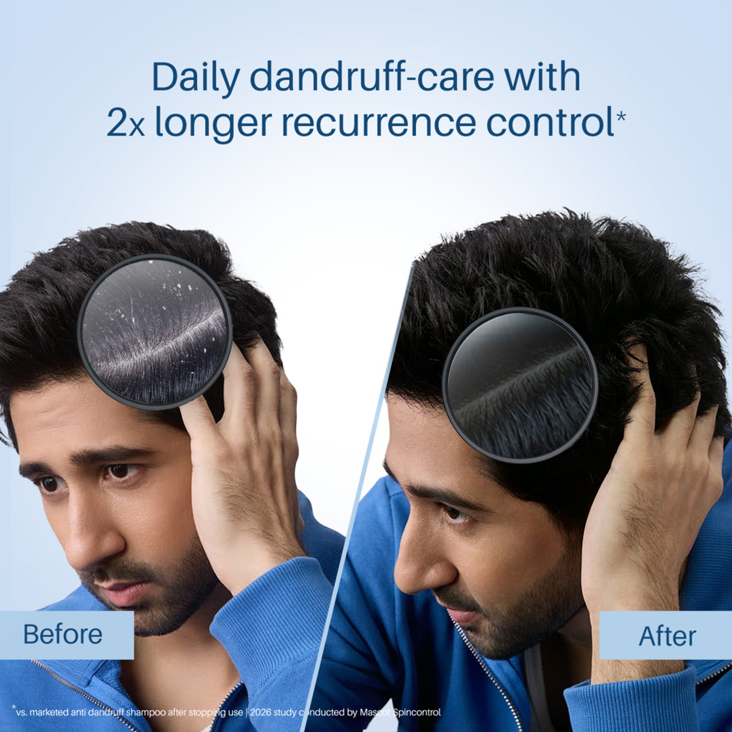 Image of Scalpe Pro Daily Anti Dandruff Shampoo