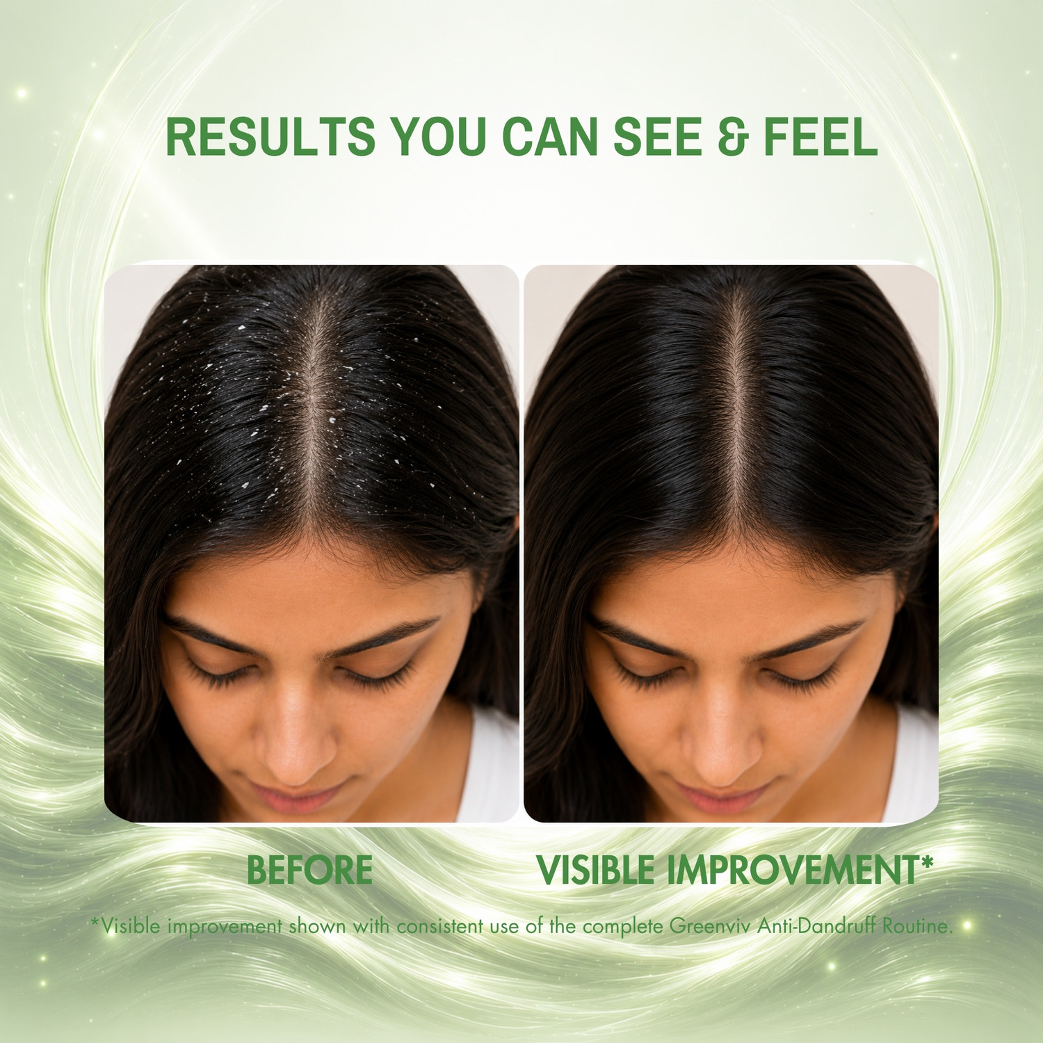 Image of Greenviv Anti Dandruff Shampoo for Itchy Scalp & Flake Control with Zinc Pyrithione