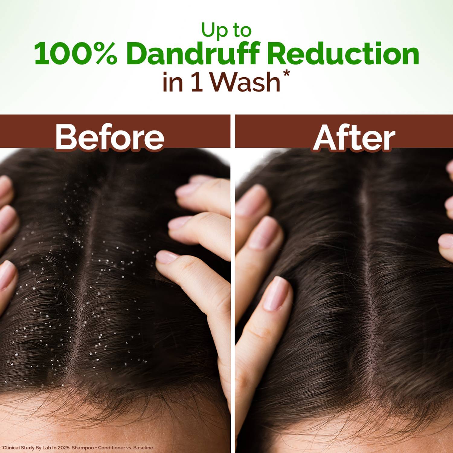 Mamaearth Lemon Anti-Dandruff Shampoo 1 Wash 1 Washes - Image 5