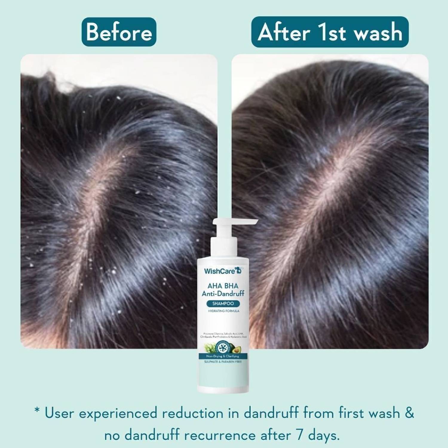WishCare Hydrating Anti Dandruff Shampoo 250 ml - Image 3