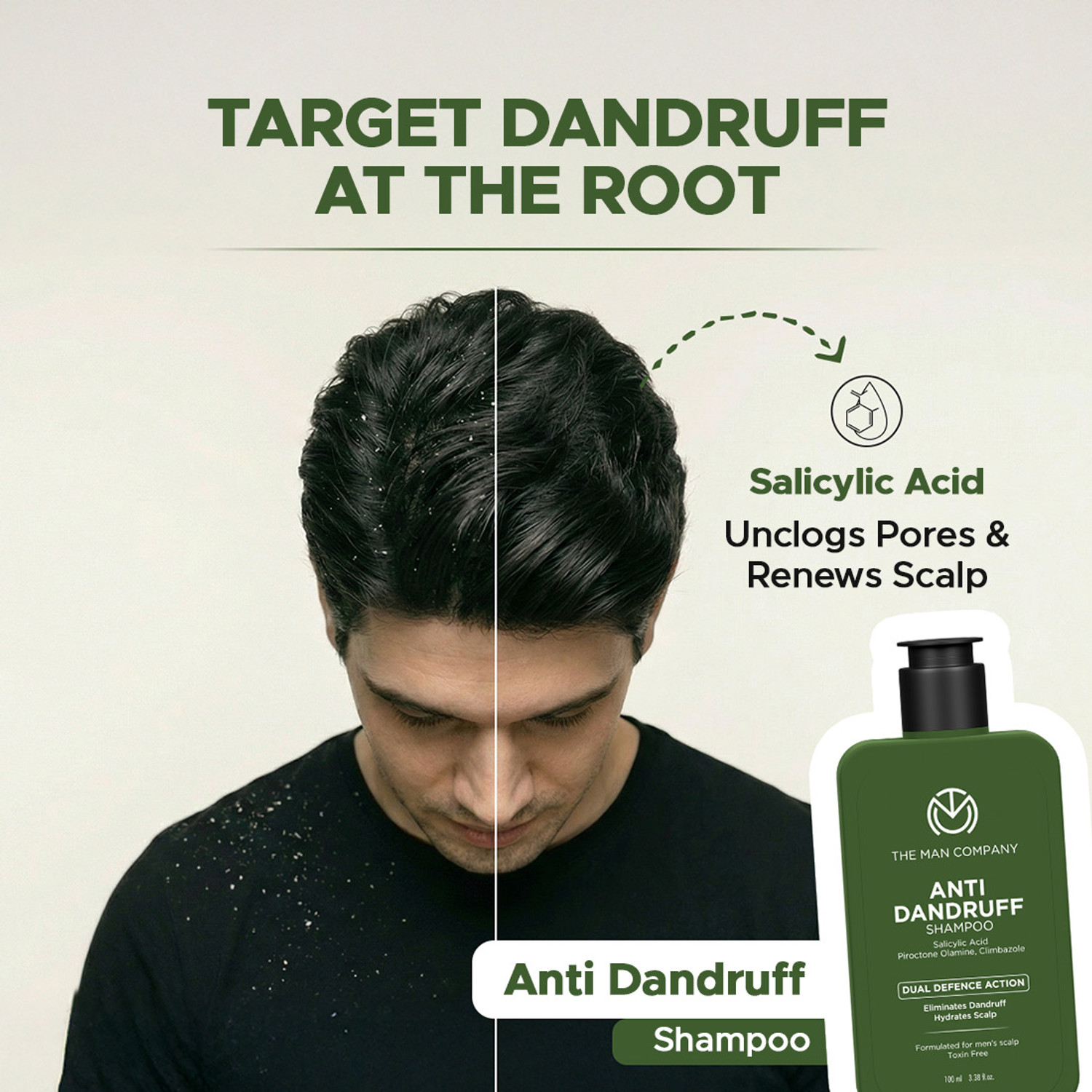 Image of THE MAN COMPANY Anti Dandruff Shampoo for Men | Salicylic Acid | Fights Dandruff & Itchy Scalp