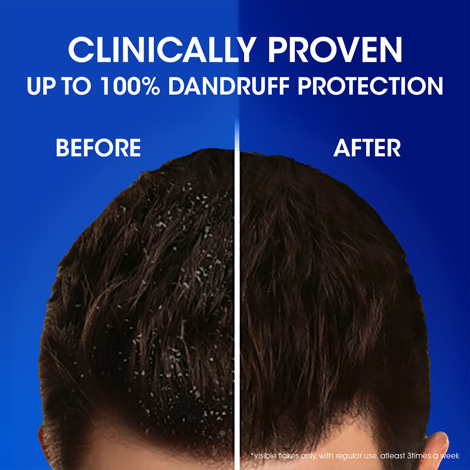 Image of HEAD & SHOULDERS Cool Menthol Anti-Dandruff Shampoo for Men & Women