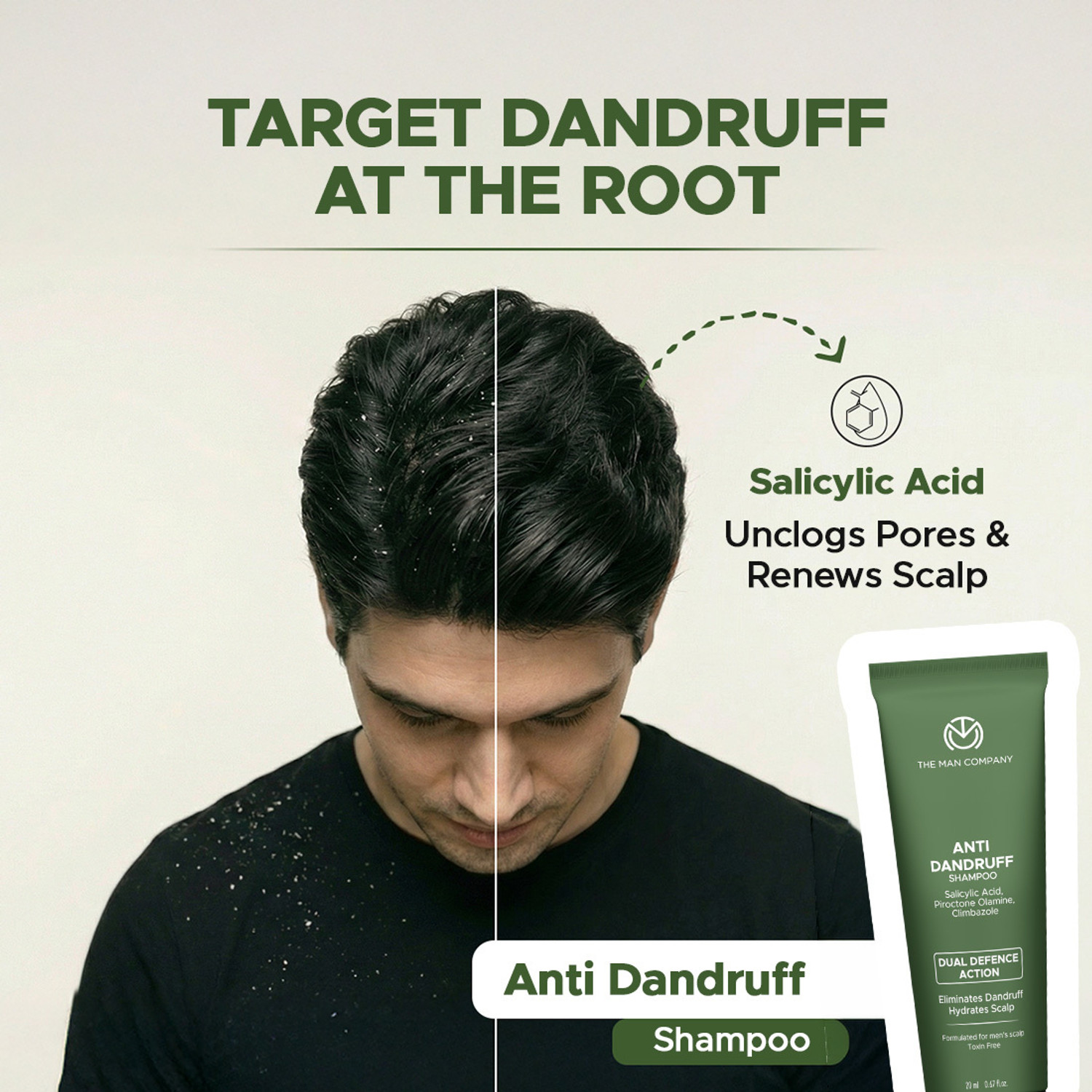 Image of THE MAN COMPANY Anti Dandruff Shampoo for Men| 2% Salicylic Acid| Fights Dandruff & Itchy Scalp