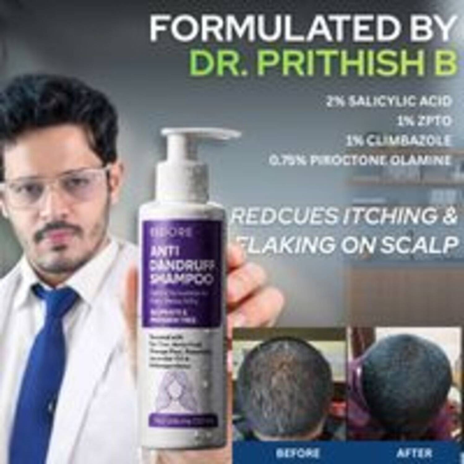 FIDORE Anti Dandruff Shampoo - Image 5