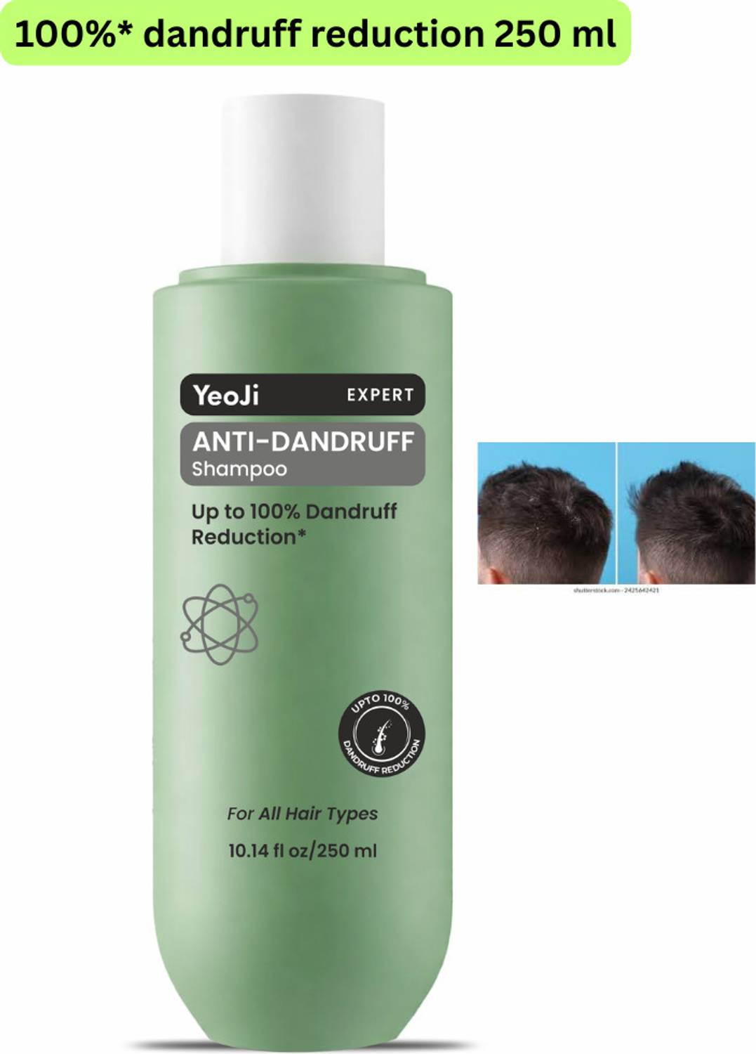 YeoJi Anti-Dandruff Shampoo for Oily Scalp 250 ml - Image 1