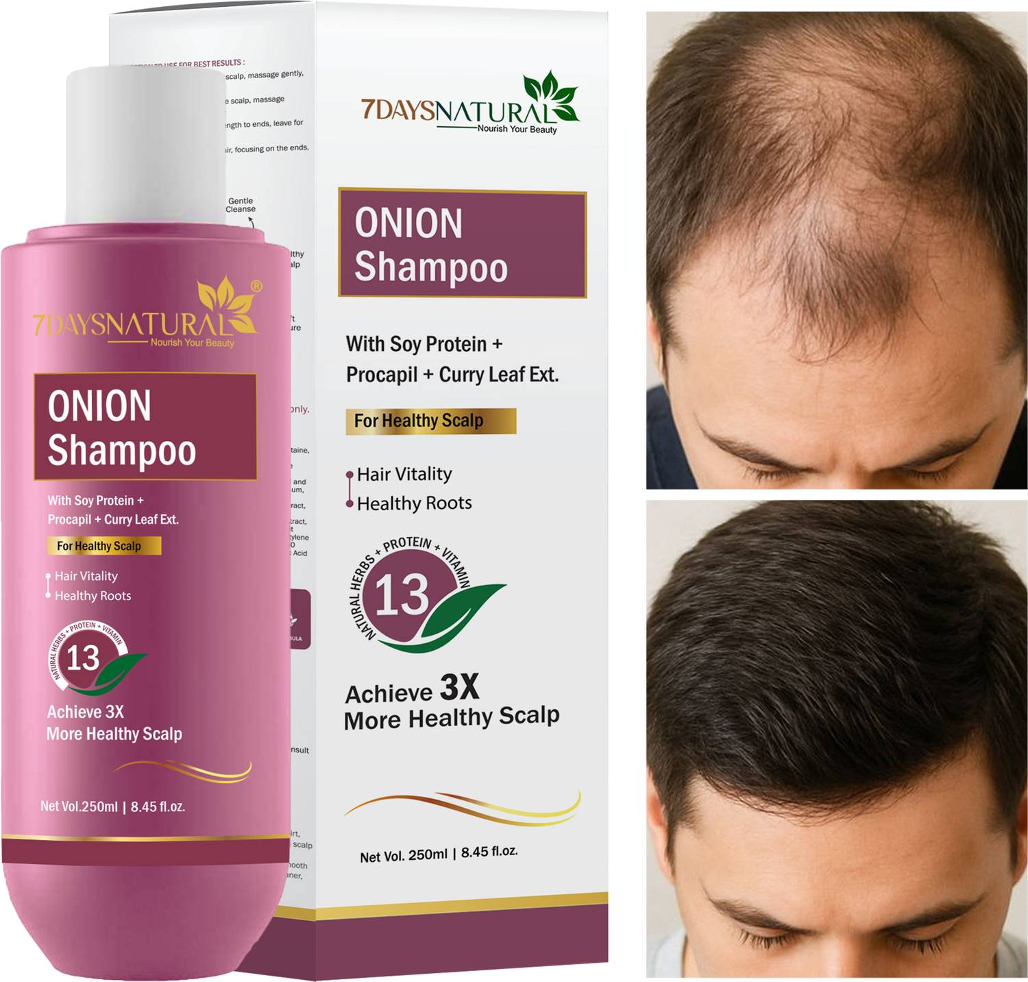 7days natural Onion Shampoo For Hair Growth anti hair fall dandruff control hair loss problem