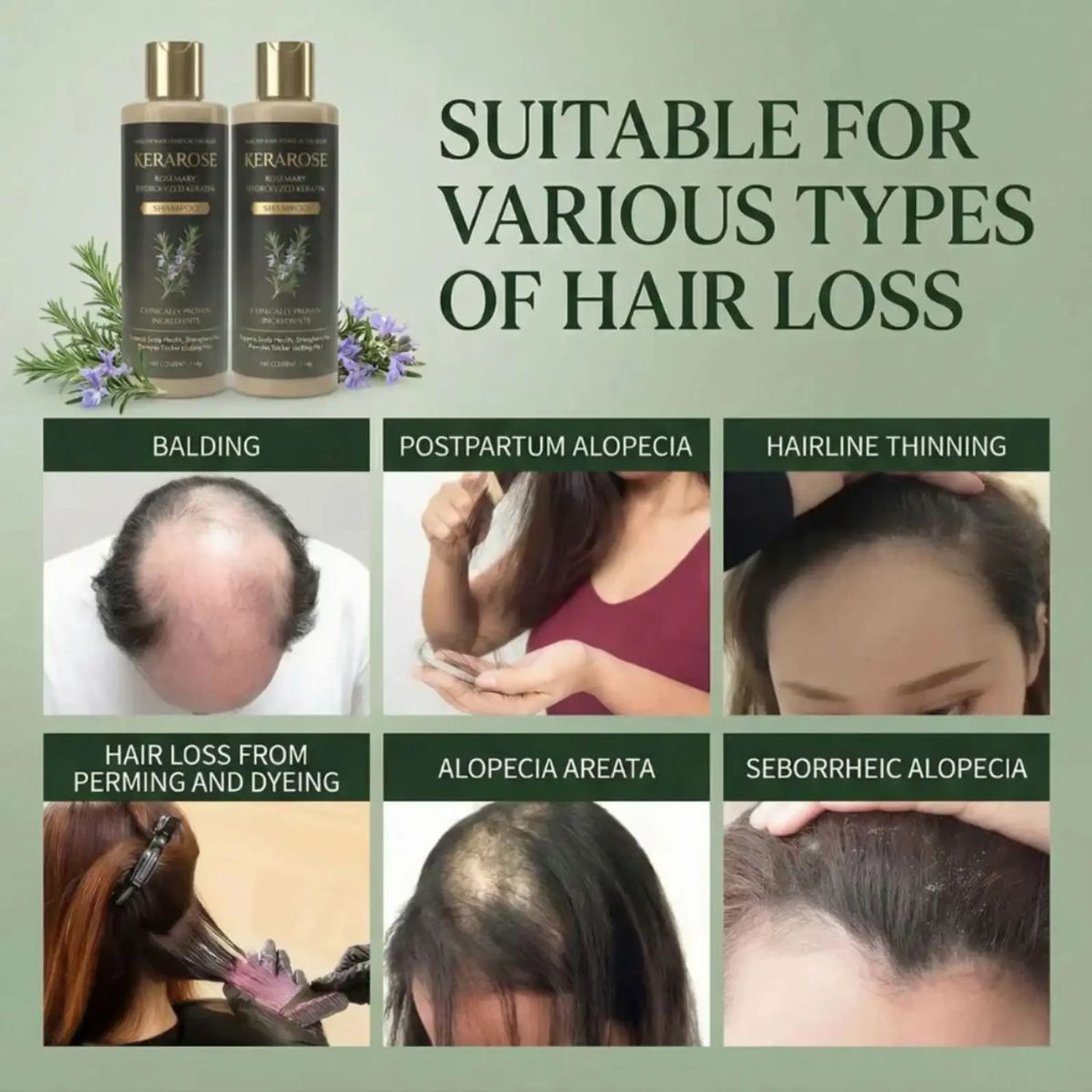 Image of RIDOY natural rosemary shampoo | Daily Hair Care Essential Cleansing Edition -