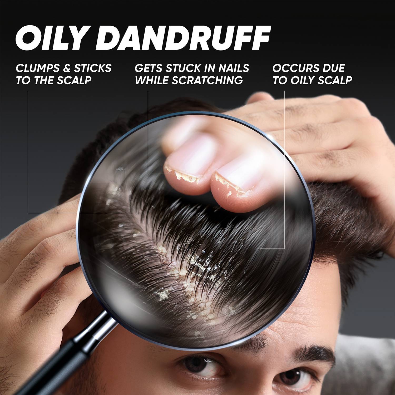 HEAD & SHOULDERS Oily Sticky Dandruff Deep Cleanse - Image 4