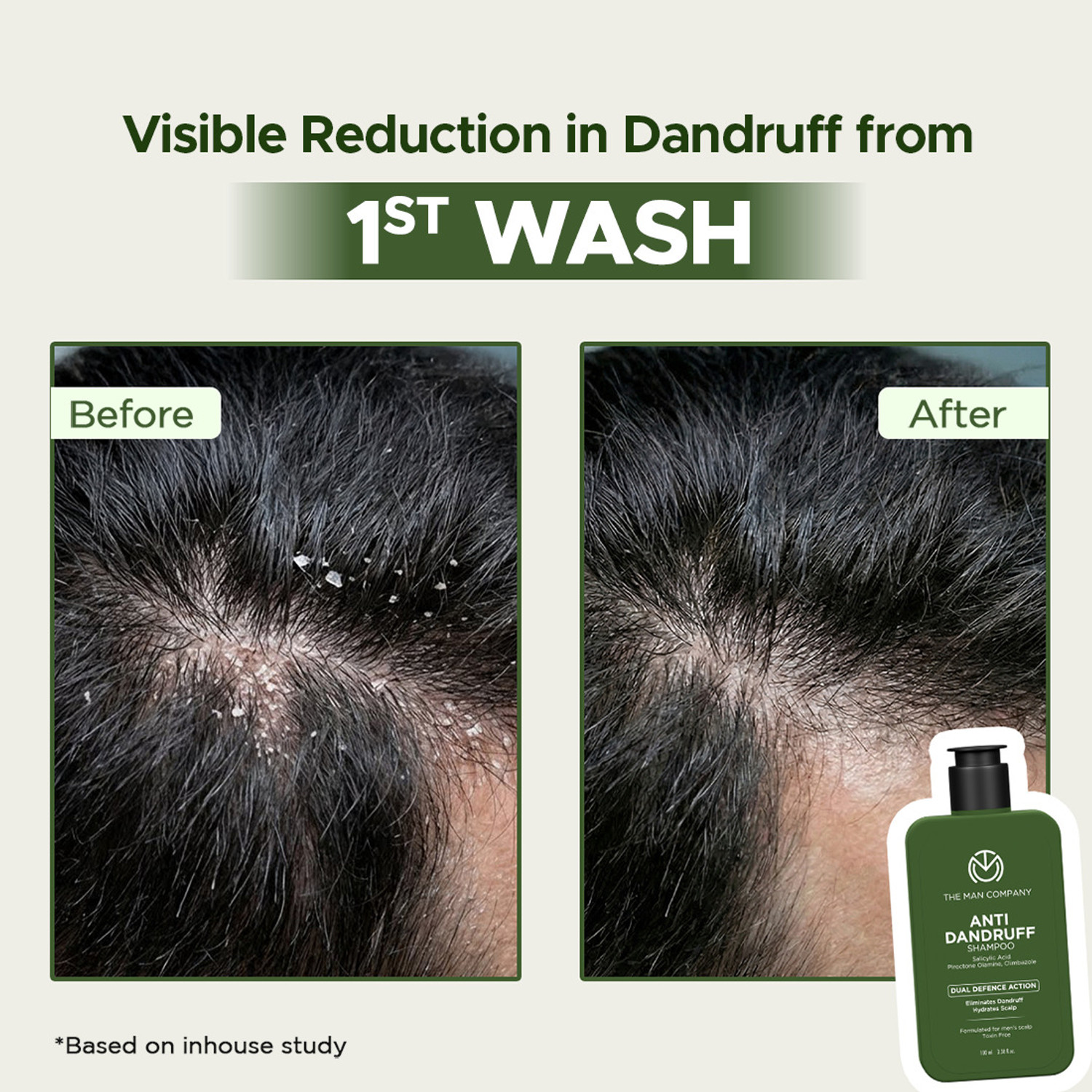 Image of THE MAN COMPANY Anti Dandruff Shampoo for Men | Salicylic Acid | Fights Dandruff & Itchy Scalp