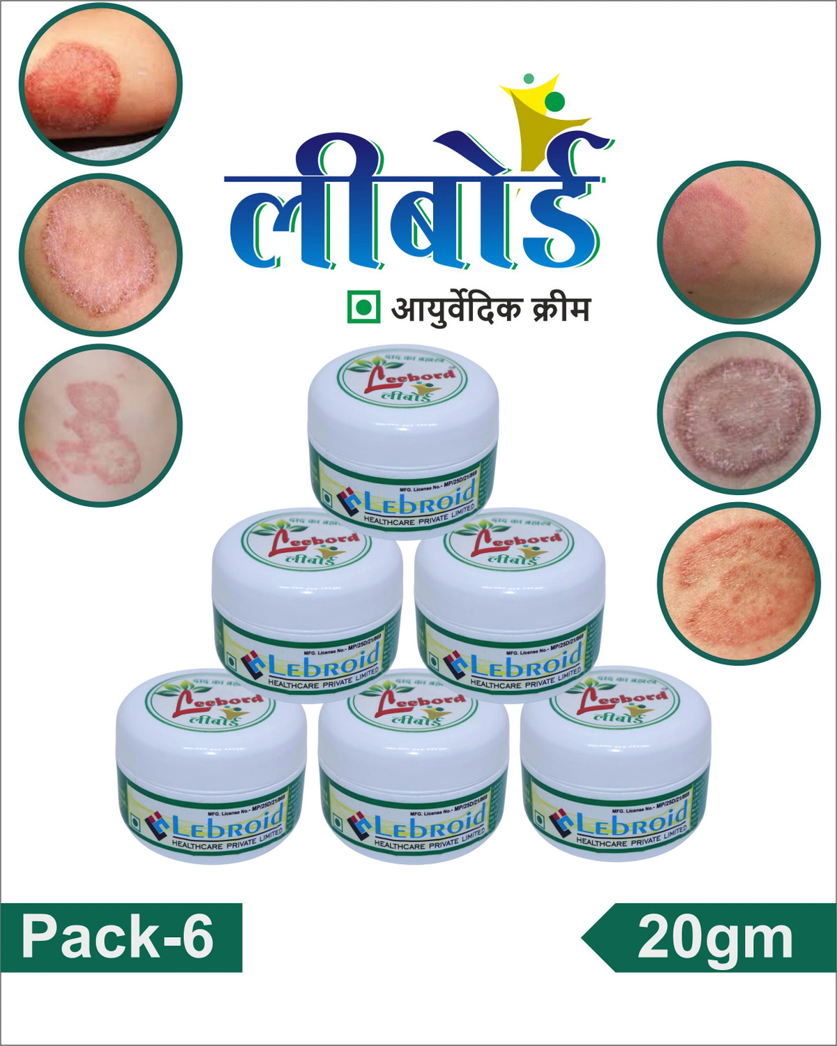 Image of leebord Cream For Ringworm
