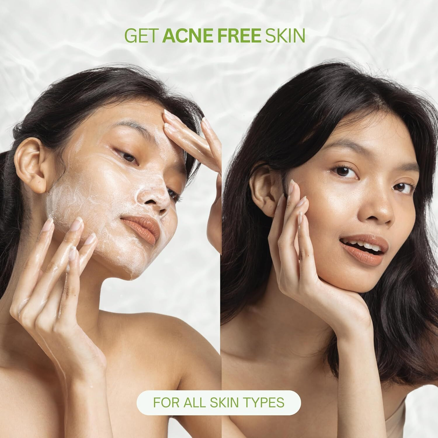 Image of DermaTreat Essentials Acne Control with Salicylic Acid | Reduces Pimples, Clears Pores and Prevents Breakouts | For Oily and Acne-Prone Skin | Pack of 2 Face Wash