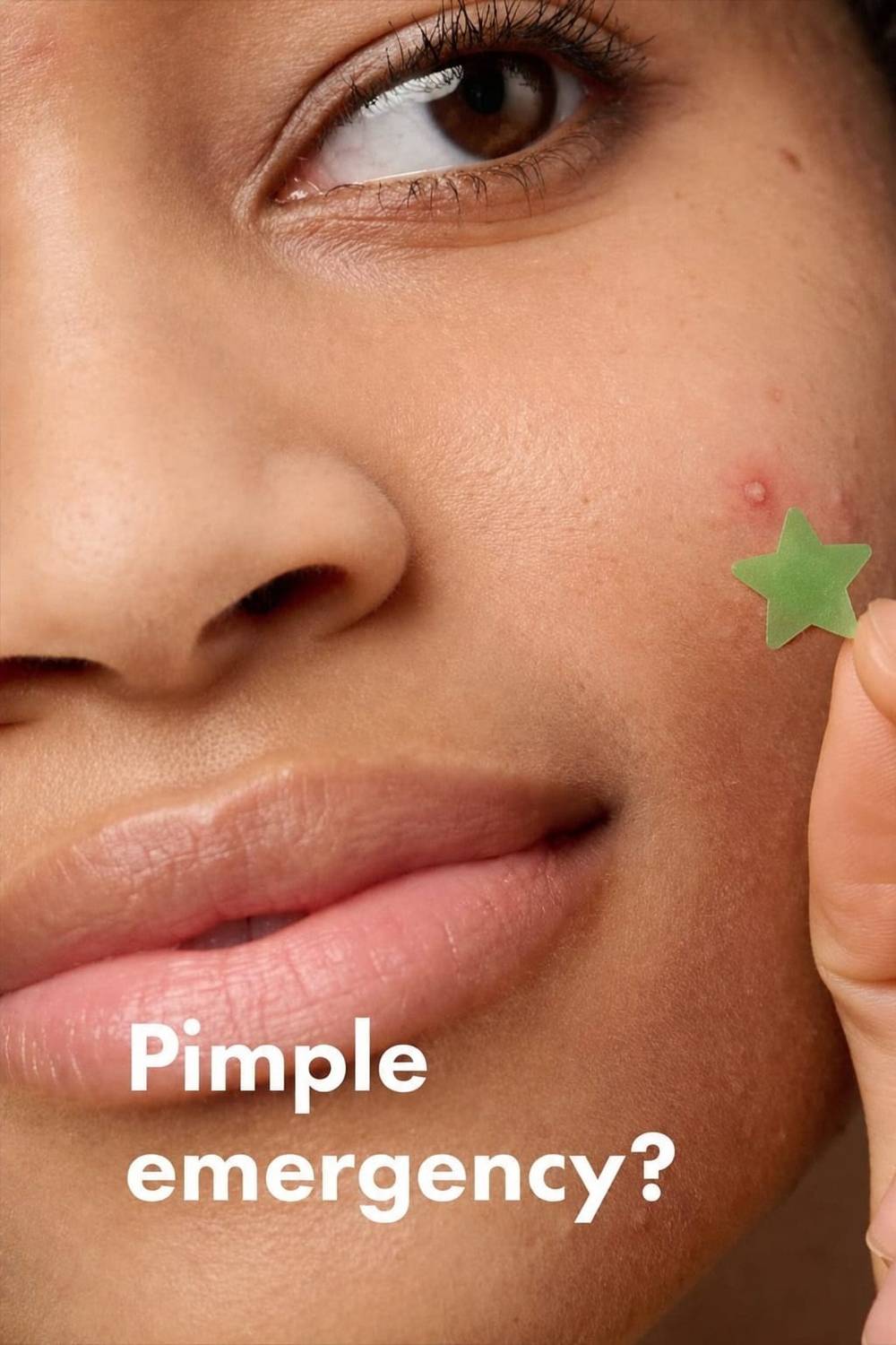 imelda Acne Pimple Patch For Zits - Image 3