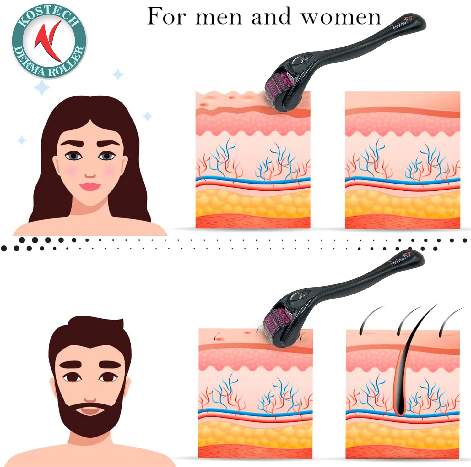 Image of Kostech KDR 0.5mm with 540 Titanium Derma Roller For Anti-aging, Anti-wrinkle, Acne Scar Removal