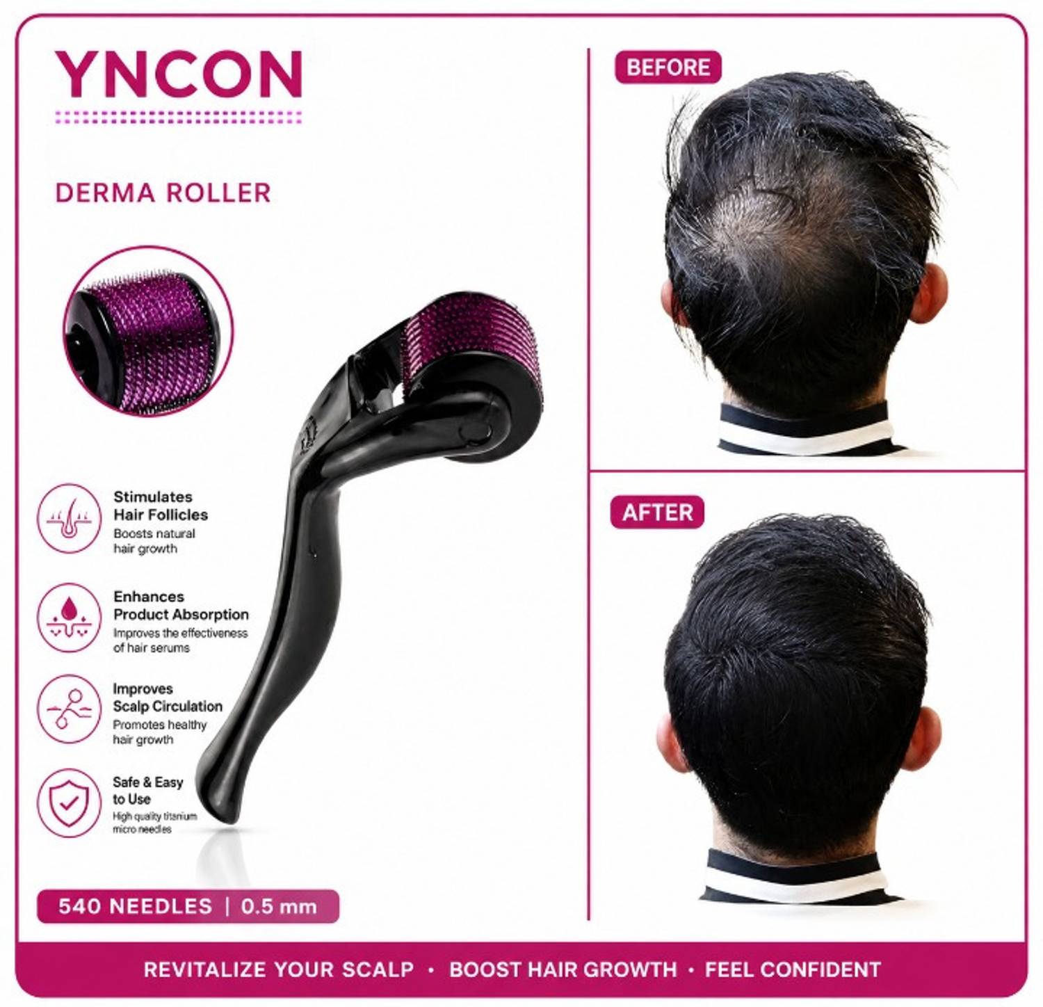 YNCOS Advanced Hair Growth Serum 2 Items - Image 5