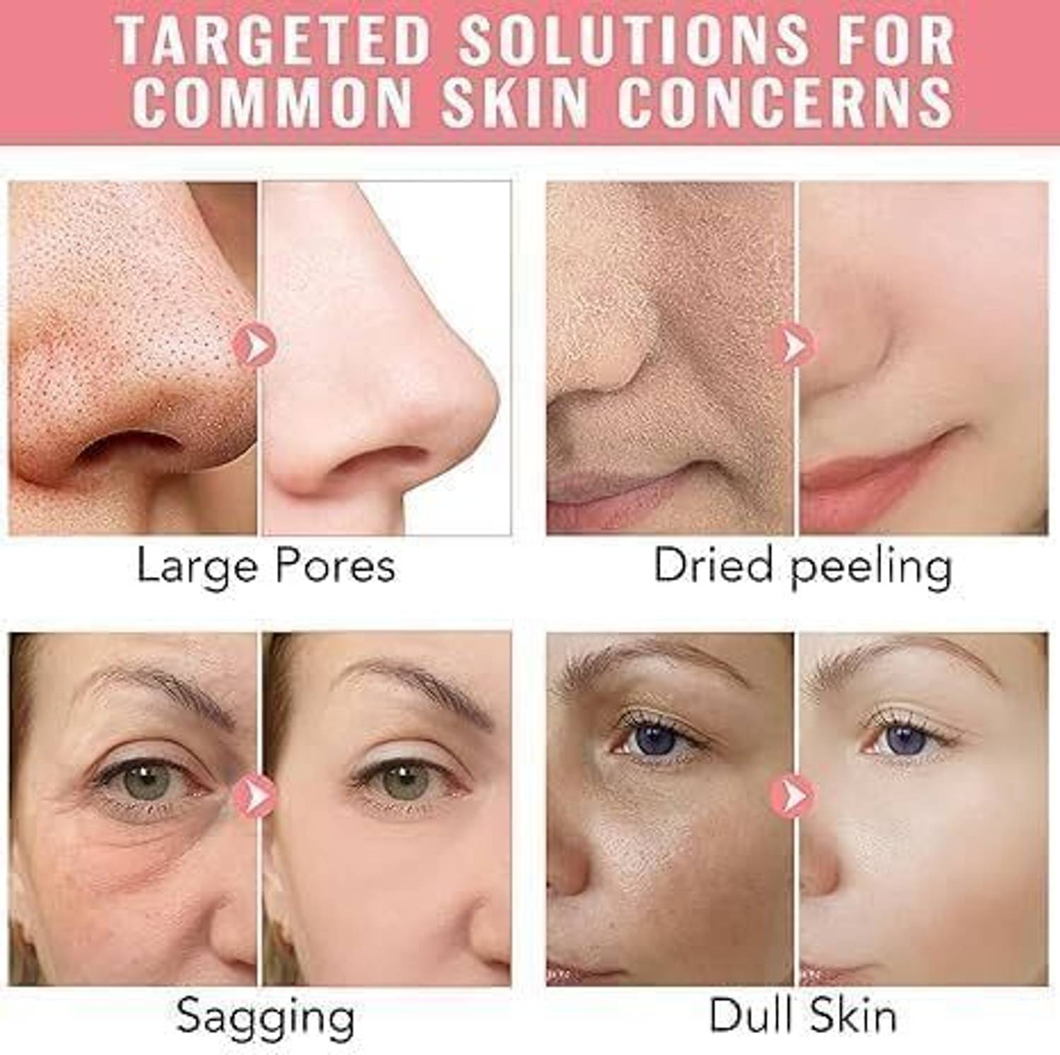 MVIQEHAA 4pcs Korean Glass Skin Hydrogel Mask - Image 4