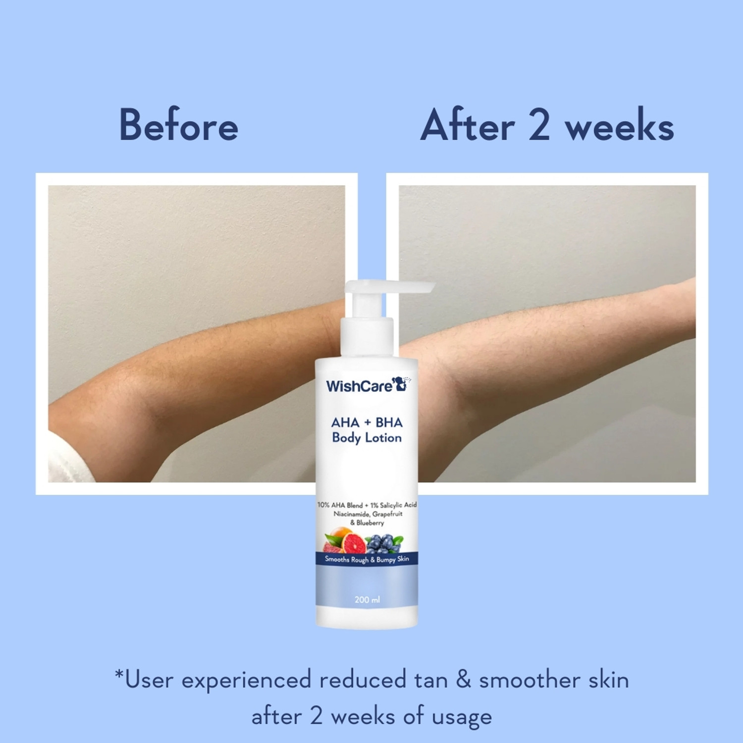 Image of WishCare 10% AHA + 1% BHA Body Lotion - Smooths Rough & Bumpy Skin - With Niacinamide