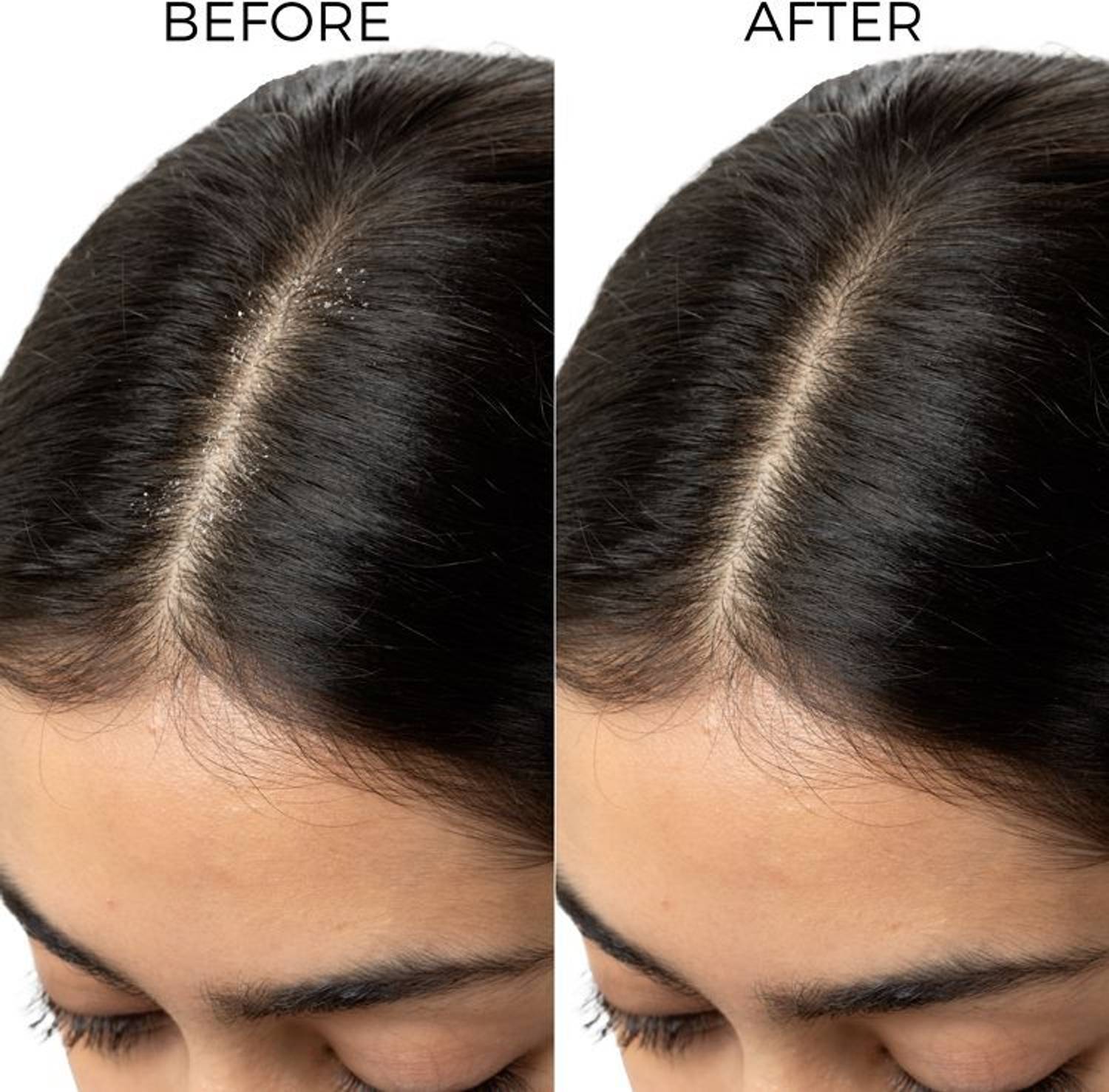 BRILLARE Natural Lactylate Anti-Dandruff Shampoo - Image 4