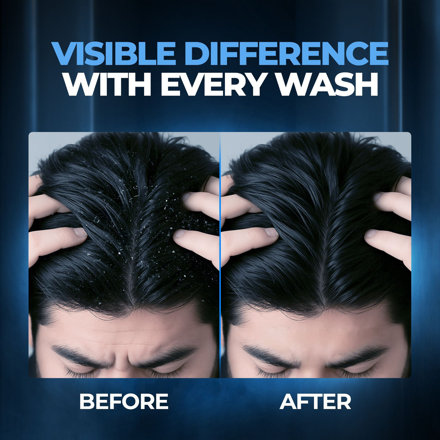 Image of BEARDO Dandruff Control Sulphate Free Shampoo | Reduce Dandruff and Itchy Scalp