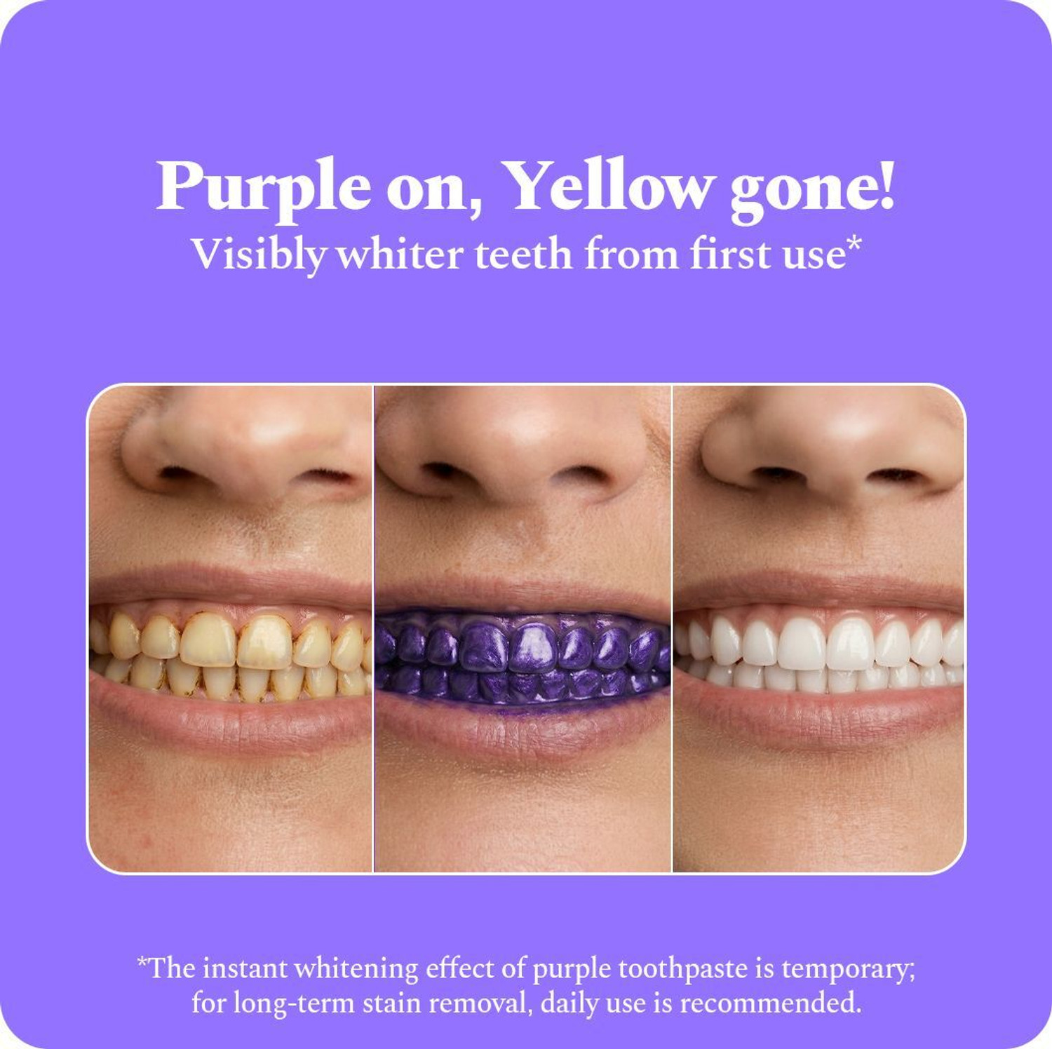 Image of Perfora Purple Whitening Toothpaste, Color Corrector Formula, SLS Free Toothpaste