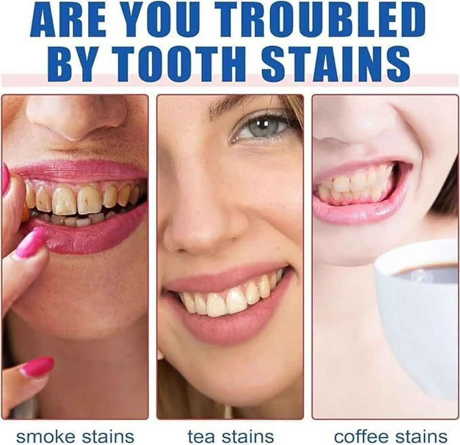 Image of sp 4 Whitening Toothpaste | Next-Generation Teeth Whitening Toothpaste Innovation Toothpaste