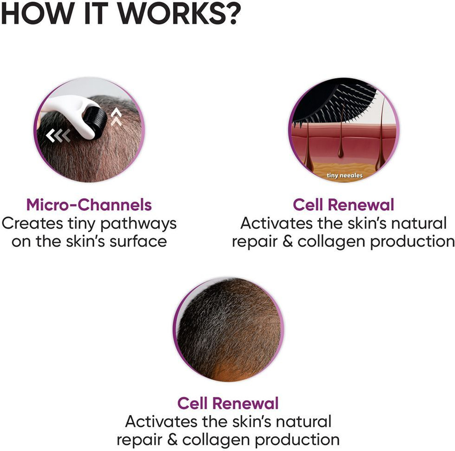 Image of Dermasys Derma Roller for Hair Growth 0.5mm with 540 Titanium Needles for Men & Women