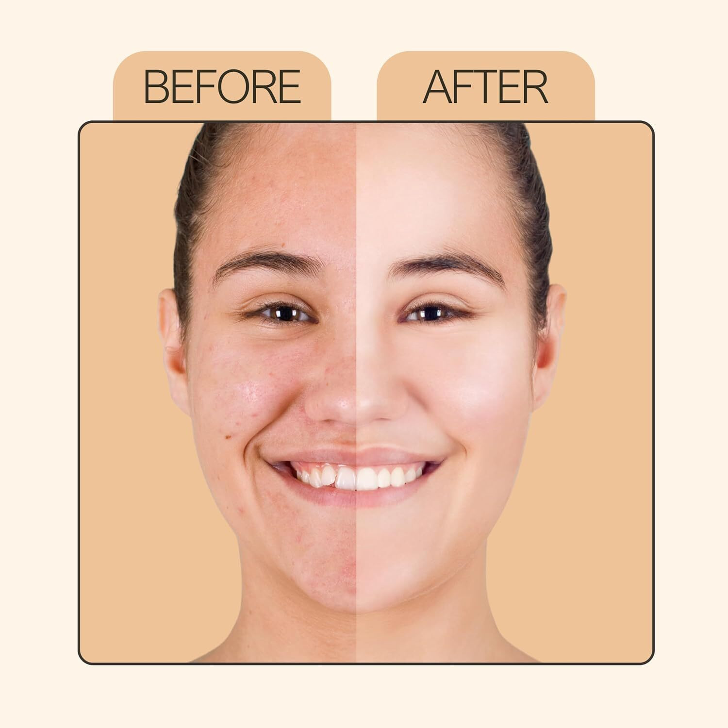 Image of DermaTreat Essentials 10% Vitamin C Face Serum with Niacinamide & Hyaluronic Acid | Reduces Dark Spots & Treats Pigmentation | For Glowing Skin