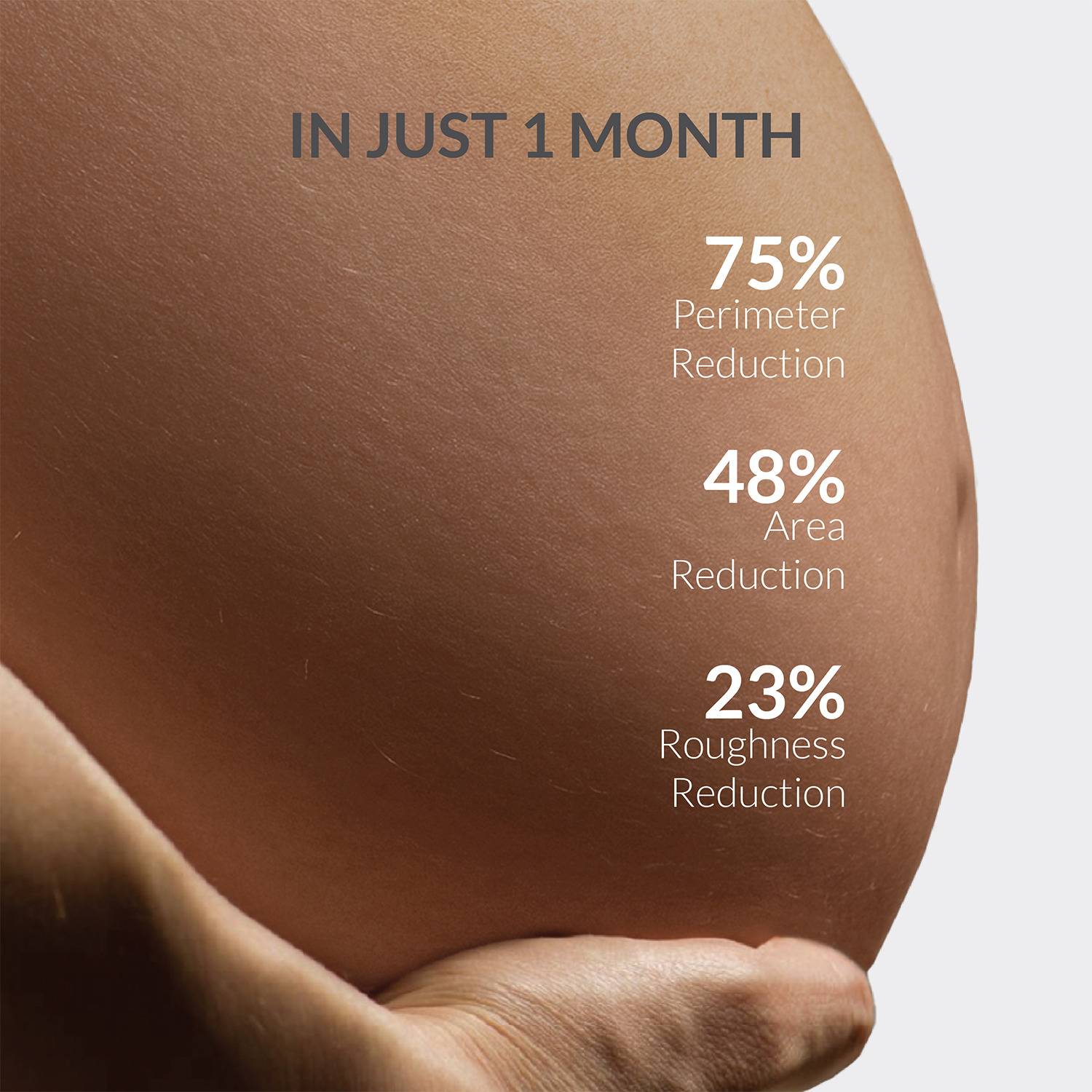 Areoveda Stretch Marks Cream - Image 5