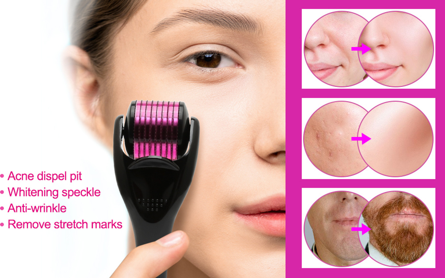 Image of DIDMENT Derma Roller + Hair Scalp Massager Brush + Face Ice Roller Combo