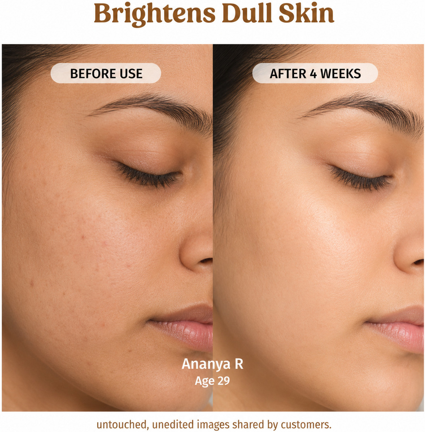 Image of vilvah Milk Drops Brightening Serum - Rice Milk, Marine Algae & Alpha Arbutin Formula