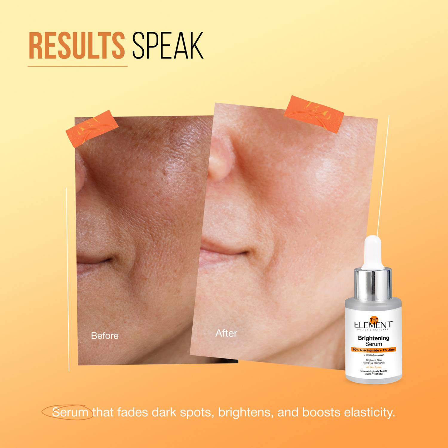 the element Skin Brightening Drops 30ml, Pack of 3 - Image 4