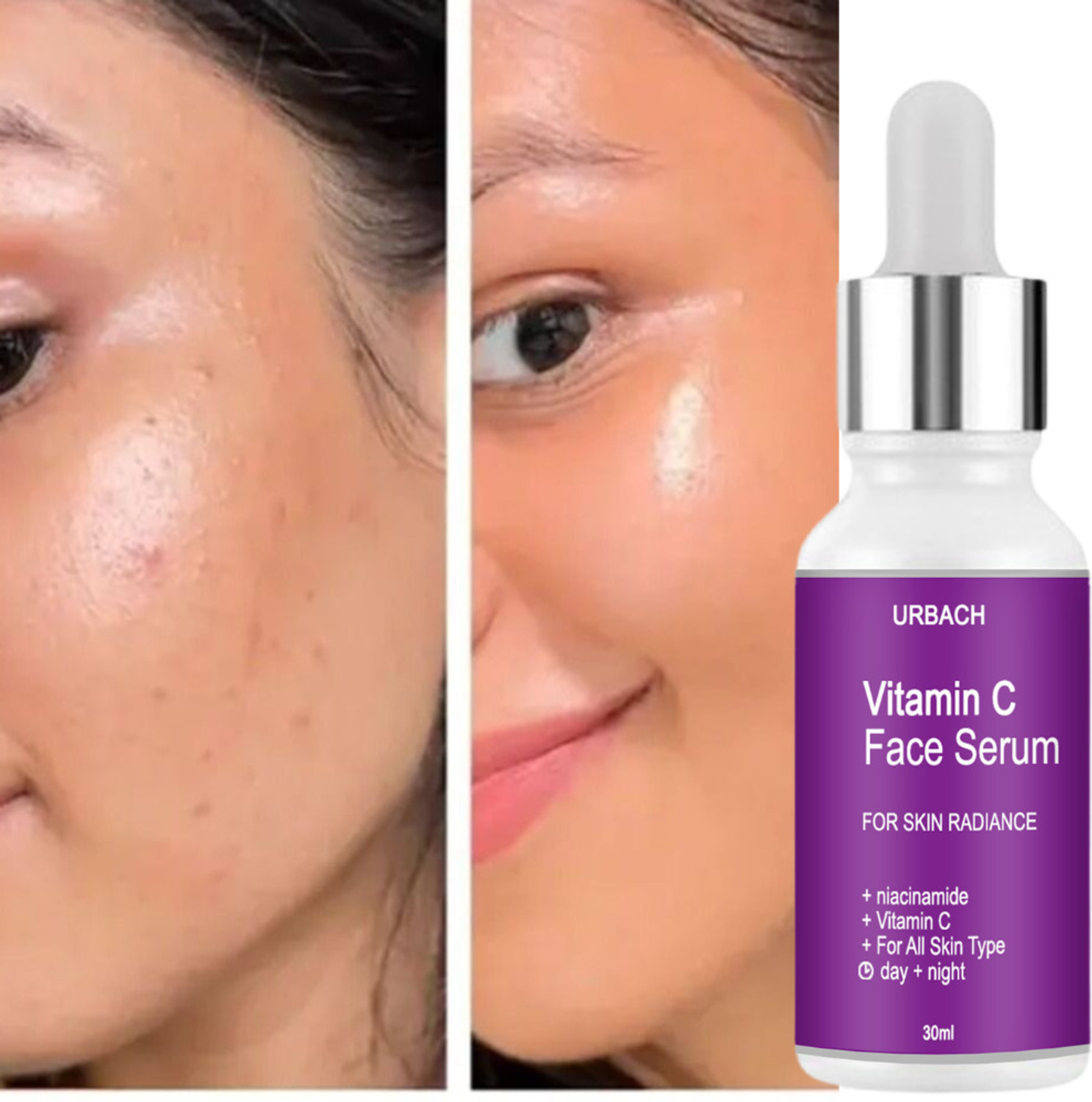 Image of urbach Professional Vitamin C Face Serum for men and women