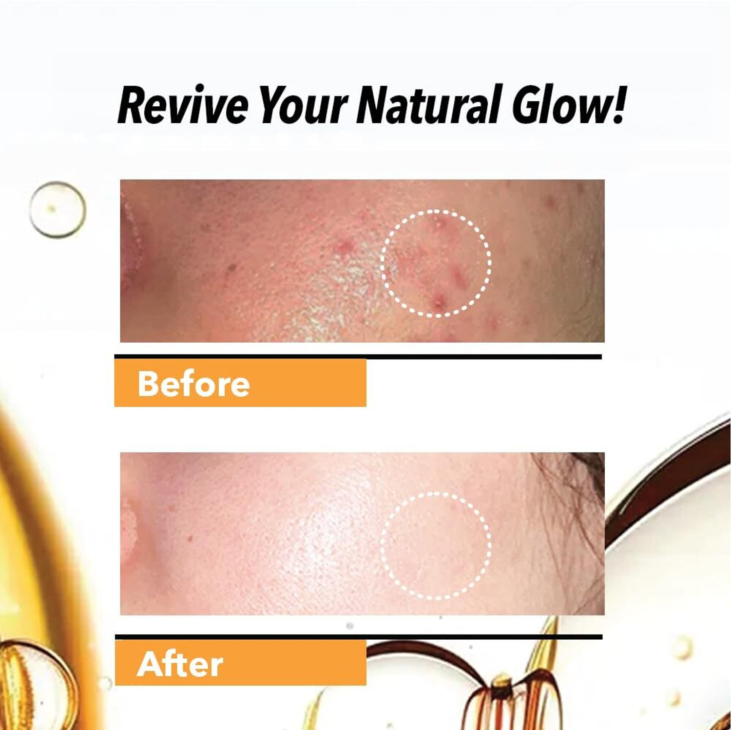 Image of urbach Professional Vitamin C Face Serum for men and women