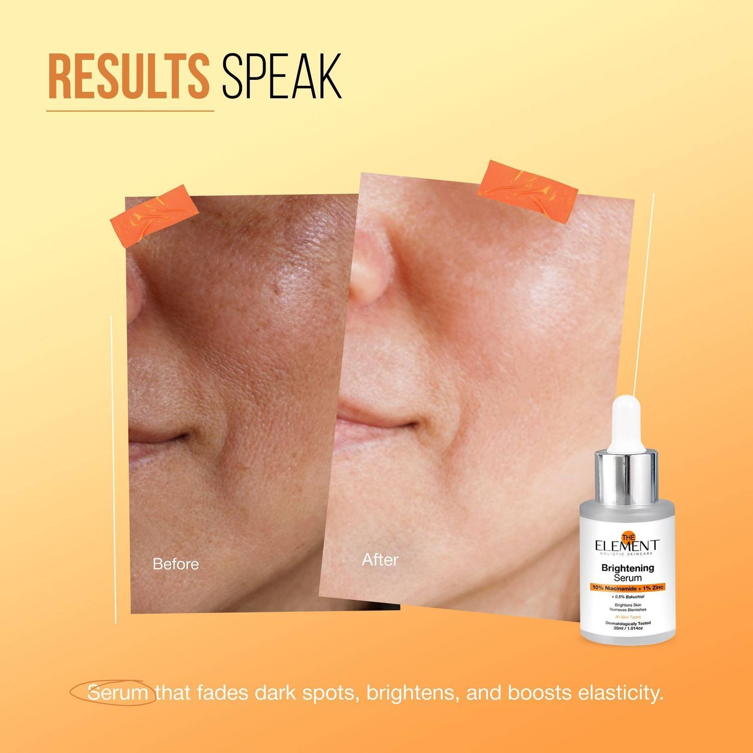 the element 10% Niacinamide Serum with 1% Zinc PCA, 0.5% Bakuchiol