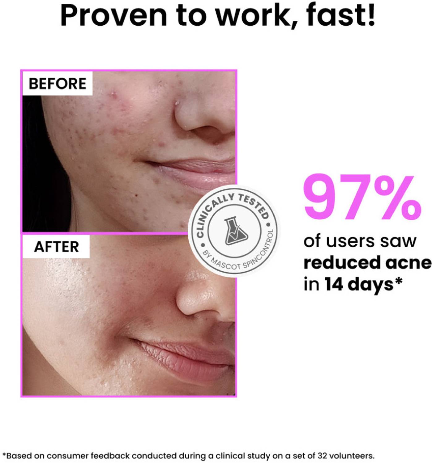Foxtale 12% Niacinamide Serum 30ml - Image 4