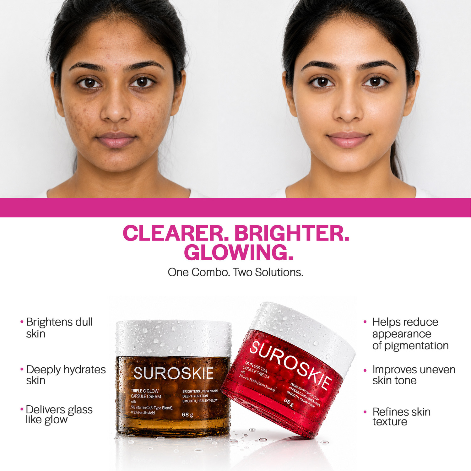 Image of Suroskie Triple Glow & Spotless TXA Capsule Cream Combo