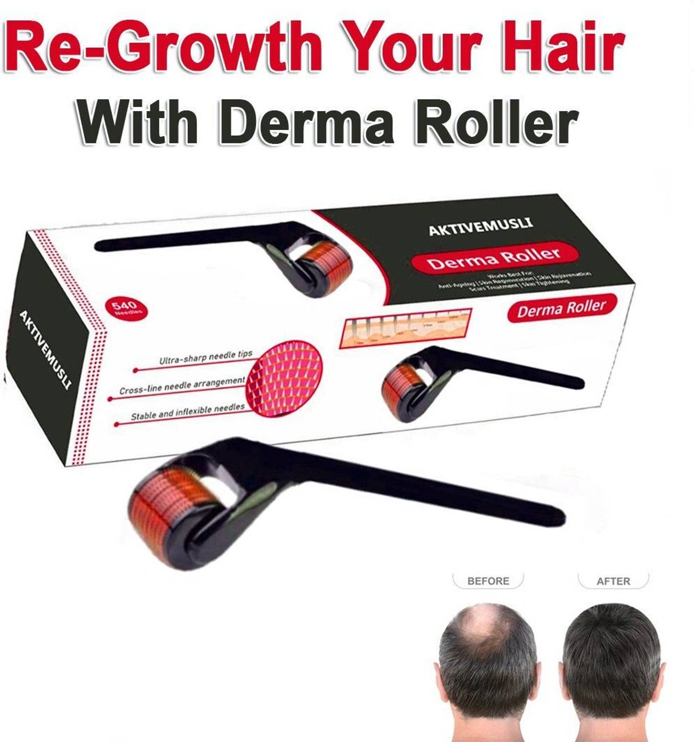 Aktivemusli Derma Roller for Men | For Scalp & Beard | 540 Micro 0.5mm
