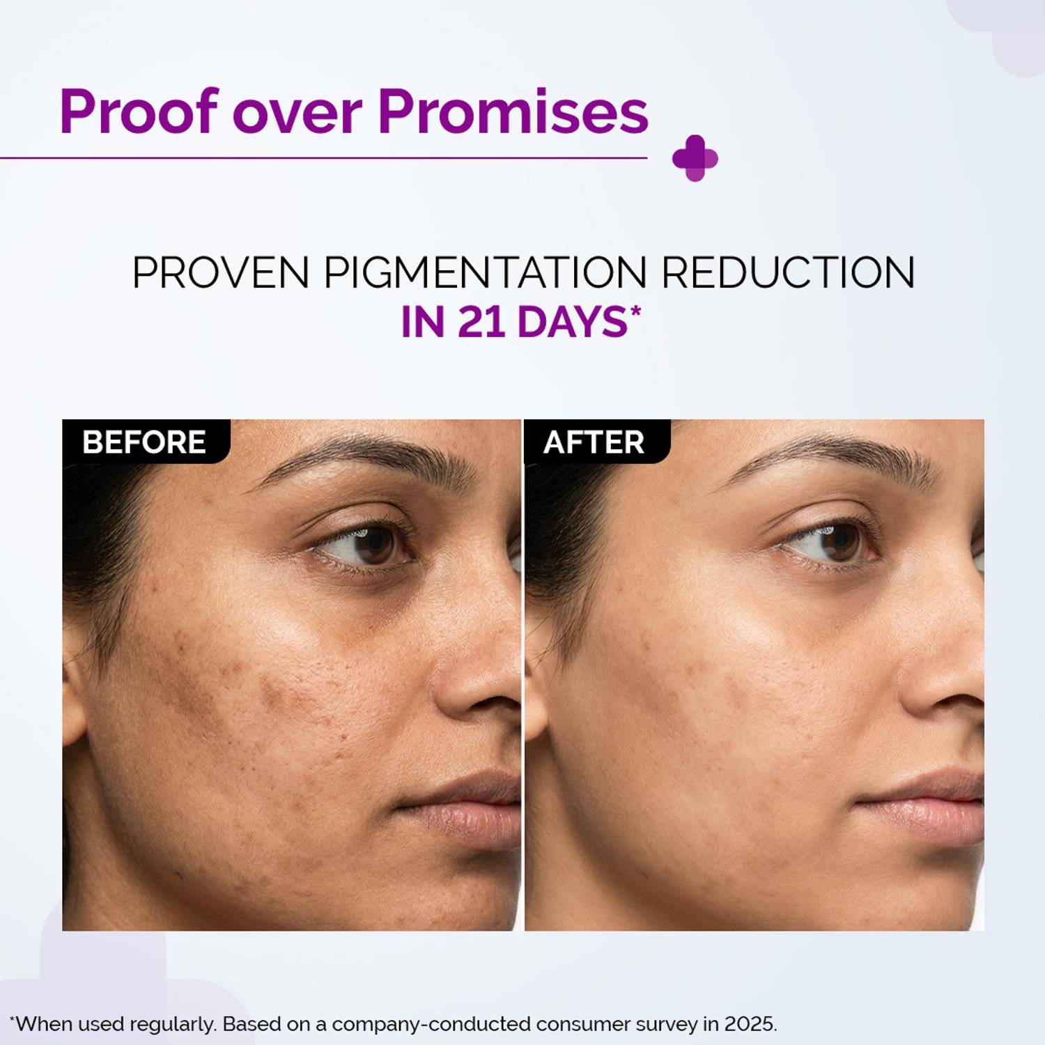 The Derma Co 2% Kojic Acid Face Serum 30ml - Image 4