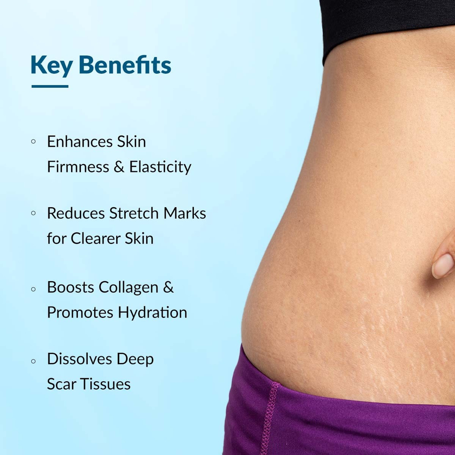 Image of Fixderma Strallium Stretch Mark Cream, Removes Pregnancy stretch marks, thighs & all body parts