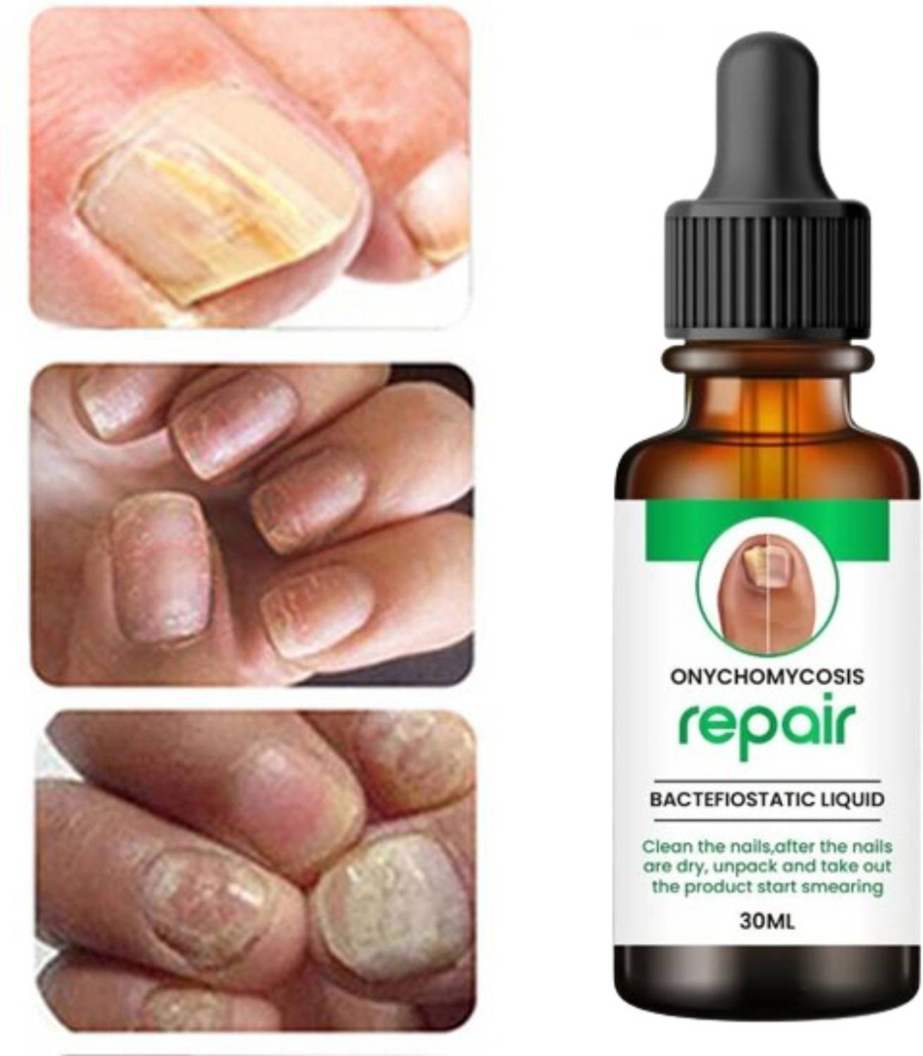 KORAT KING Nail Serum Boost Nail Strong & Repair Nails Serum.