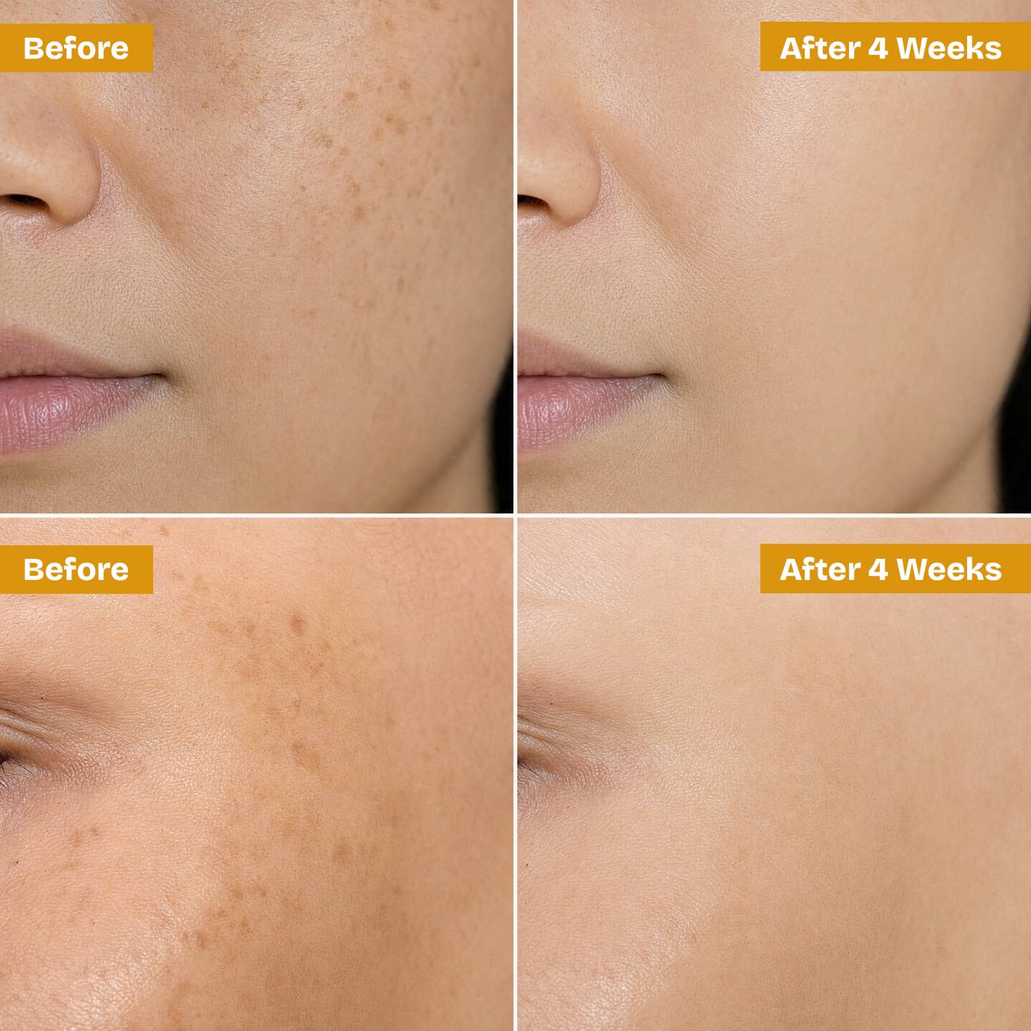 Proskire Advance Vitamin C Face Serum - Image 4