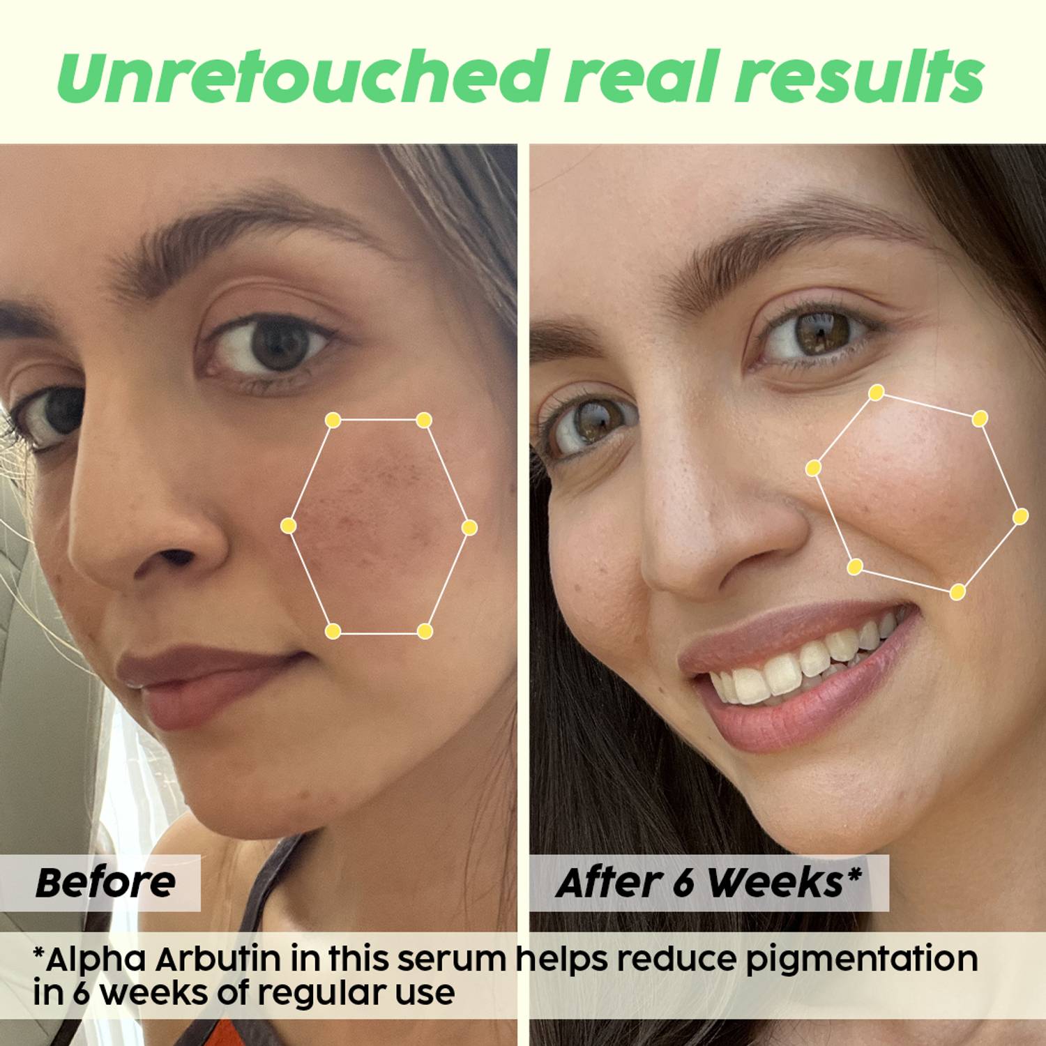The Plant Fix Plix 2% Alpha Arbutin Pineapple Serum - Image 3